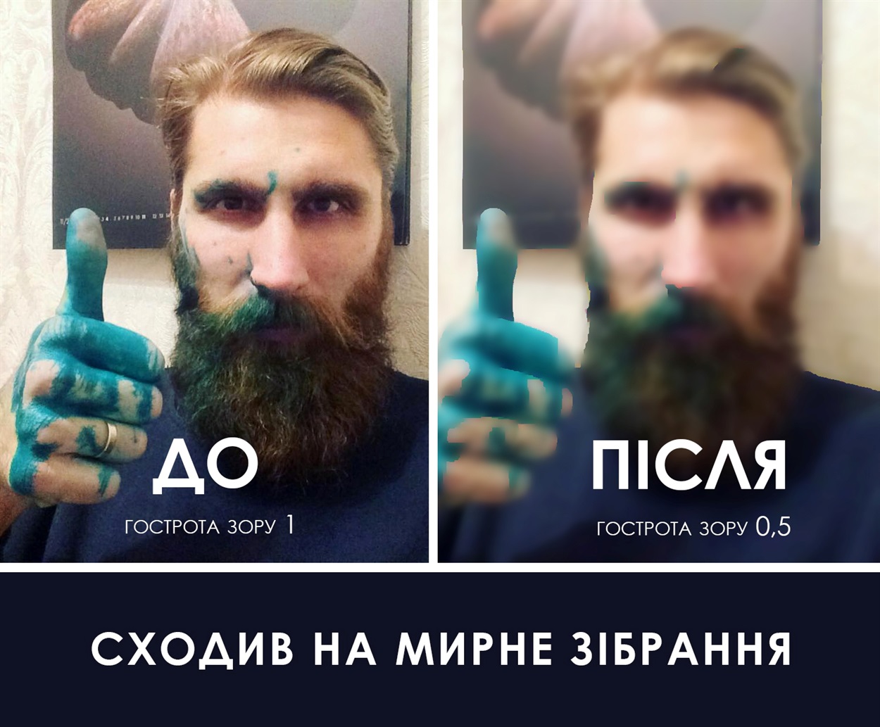 Після нападу Павло втратив гостроту зору